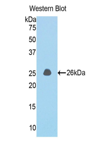 CCDC80 Antibody - Western blot of recombinant CCDC80.  This image was taken for the unconjugated form of this product. Other forms have not been tested.