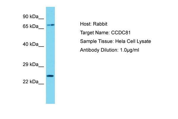 CCDC81 Antibody -  This image was taken for the unconjugated form of this product. Other forms have not been tested.
