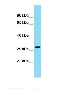 CCDC82 Antibody - Western blot of Human ACHN. CCDC82 antibody dilution 1.0 ug/ml.  This image was taken for the unconjugated form of this product. Other forms have not been tested.