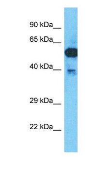 CCDC82 Antibody - Western blot of CCDC82 Antibody with HepG2 Whole Cell lysate.  This image was taken for the unconjugated form of this product. Other forms have not been tested.