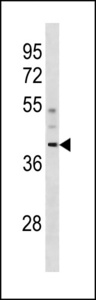 CCDC83 Antibody - CCDC83 Antibody western blot of human placenta tissue lysates (35 ug/lane). The CCDC83 antibody detected the CCDC83 protein (arrow).