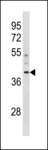 CCDC83 Antibody - CCDC83 Antibody western blot of human placenta tissue lysates (35 ug/lane). The CCDC83 antibody detected the CCDC83 protein (arrow).