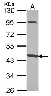 CCDC83 Antibody - Sample (30 ug of whole cell lysate). A: JurKat. 10% SDS PAGE. CCDC83 antibody. CCDC83 antibody diluted at 1:1000.