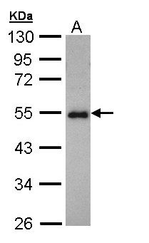 CCDC83 Antibody - Sample (30 ug of whole cell lysate). A: Hep G2 . 10% SDS PAGE. CCDC83 antibody diluted at 1:1000