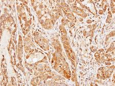 CCDC83 Antibody - IHC of paraffin-embedded A549 xenograft using CCDC83 antibody at 1:500 dilution.