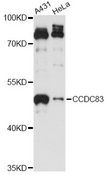 CCDC83 Antibody - Western blot analysis of extracts of various cell lines, using CCDC83 antibody at 1:3000 dilution. The secondary antibody used was an HRP Goat Anti-Rabbit IgG (H+L) at 1:10000 dilution. Lysates were loaded 25ug per lane and 3% nonfat dry milk in TBST was used for blocking. An ECL Kit was used for detection and the exposure time was 10s.