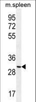 CCDC84 Antibody - CCDC84 Antibody western blot of mouse spleen tissue lysates (35 ug/lane). The CCDC84 antibody detected the CCDC84 protein (arrow).
