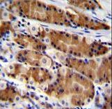 CCDC84 Antibody - CCDC84 Antibody immunohistochemistry of formalin-fixed and paraffin-embedded human stomach tissue followed by peroxidase-conjugated secondary antibody and DAB staining.