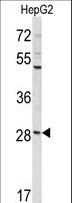 CCDC85B Antibody - Western blot of DIPA Antibody in HepG2 cell line lysates (35 ug/lane). DIPA (arrow) was detected using the purified antibody.