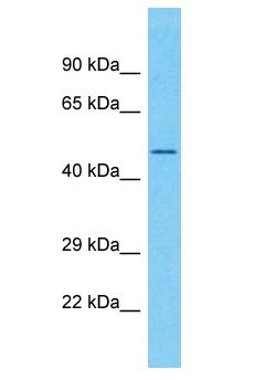 CCDC85C Antibody - CCDC85C antibody Western Blot of Fetal Lung. Antibody dilution: 1 ug/ml.  This image was taken for the unconjugated form of this product. Other forms have not been tested.