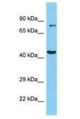 CCDC85C Antibody - CCDC85C antibody Western Blot of MCF7. Antibody dilution: 1 ug/ml.  This image was taken for the unconjugated form of this product. Other forms have not been tested.