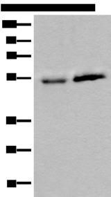 CCDC85C Antibody - Western blot analysis of Human fetal intestines tissue and Human breast cancer tissue lysates  using CCDC85C Polyclonal Antibody at dilution of 1:400