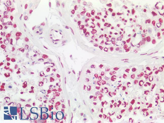 CCDC86 Antibody - Human Testis, Nuclear Staining: Formalin-Fixed, Paraffin-Embedded (FFPE)