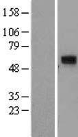 CCDC86 Protein - Western validation with an anti-DDK antibody * L: Control HEK293 lysate R: Over-expression lysate