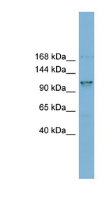 CCDC87 Antibody - CCDC87 antibody Western blot of MCF7 cell lysate. This image was taken for the unconjugated form of this product. Other forms have not been tested.