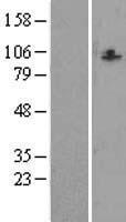 CCDC87 Protein - Western validation with an anti-DDK antibody * L: Control HEK293 lysate R: Over-expression lysate