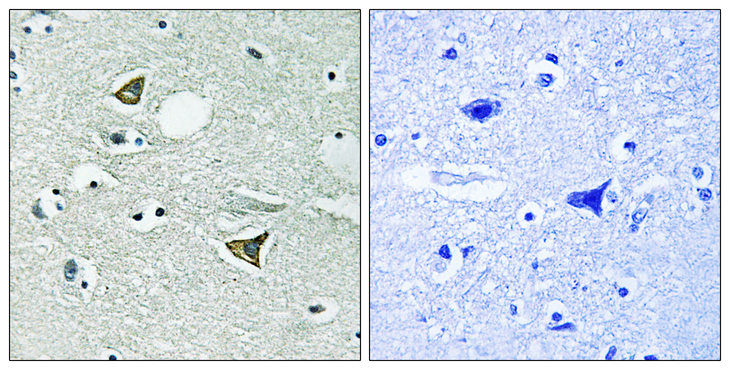 CCDC88A / GIV / Girdin Antibody - Immunohistochemistry analysis of paraffin-embedded human brain tissue, using Girdin Antibody. The picture on the right is blocked with the synthesized peptide.