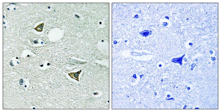 CCDC88A / GIV / Girdin Antibody - Peptide - + Immunohistochemistry analysis of paraffin-embedded human brain tissue using Girdin antibody.