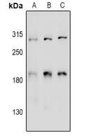 CCDC88A / GIV / Girdin Antibody - Western blot analysis of Girdin expression in K562 (A), CT26 (B), rat testis (C) whole cell lysates.