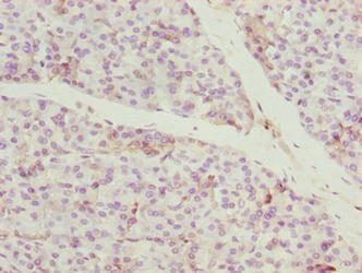 CCDC89 Antibody - Immunohistochemistry of paraffin-embedded human pancreatic tissue using CCDC89 Antibody at dilution of 1:100