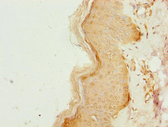 CCDC89 Antibody - Immunohistochemistry of paraffin-embedded human skin tissue using CCDC89 Antibody at dilution of 1:100