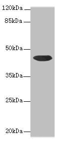 CCDC89 Antibody - Western blot All lanes: CCDC89 antibody at 1.7µg/ml + Mouse kidney tissue Secondary Goat polyclonal to rabbit IgG at 1/10000 dilution Predicted band size: 44 kDa Observed band size: 44 kDa