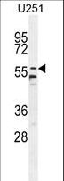 CCDC9 Antibody - CCDC9 Antibody western blot of U251 cell line lysates (35 ug/lane). The CCDC9 antibody detected the CCDC9 protein (arrow).