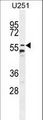 CCDC9 Antibody - CCDC9 Antibody western blot of U251 cell line lysates (35 ug/lane). The CCDC9 antibody detected the CCDC9 protein (arrow).