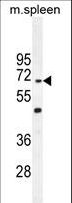 CCDC9 Antibody - CCDC9 Antibody western blot of mouse spleen tissue lysates (35 ug/lane). The CCDC9 antibody detected the CCDC9 protein (arrow).