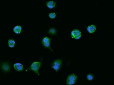 CCDC9 Antibody - Immunofluorescence staining of CCDC9 in MCF7 cells. Cells were fixed with 4% PFA, permeabilzed with 0.1% Triton X-100 in PBS, blocked with 10% serum, and incubated with rabbit anti-Human CCDC9 polyclonal antibody (dilution ratio 1:200) at 4°C overnight. Then cells were stained with the Alexa Fluor 488-conjugated Goat Anti-rabbit IgG secondary antibody (green) and counterstained with DAPI (blue). Positive staining was localized to Cytoplasm.