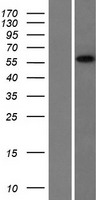 CCDC9 Protein - Western validation with an anti-DDK antibody * L: Control HEK293 lysate R: Over-expression lysate