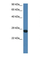 CCDC90B Antibody - CCDC90B antibody Western blot of Mouse Heart lysate. Antibody concentration 1 ug/ml.  This image was taken for the unconjugated form of this product. Other forms have not been tested.