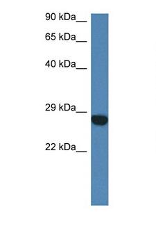 CCDC90B Antibody - CCDC90B antibody Western blot of Mouse Heart lysate. Antibody concentration 1 ug/ml.  This image was taken for the unconjugated form of this product. Other forms have not been tested.
