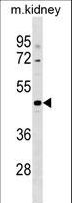 CCDC91 Antibody - CCDC91 Antibody western blot of mouse kidney tissue lysates (35 ug/lane). The CCDC91 antibody detected the CCDC91 protein (arrow).