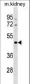 CCDC91 Antibody - CCDC91 Antibody western blot of mouse kidney tissue lysates (35 ug/lane). The CCDC91 antibody detected the CCDC91 protein (arrow).
