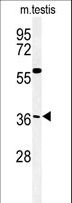 CCDC92 Antibody - Western blot of CCD92 Antibody in mouse testis tissue lysates (35 ug/lane). CCD92 (arrow) was detected using the purified antibody.