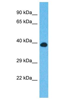 CCDC92 Antibody - CCDC92 antibody Western Blot of HepG2. Antibody dilution: 1 ug/ml.  This image was taken for the unconjugated form of this product. Other forms have not been tested.