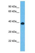 CCDC92 Antibody - CCDC92 antibody Western Blot of HepG2. Antibody dilution: 1 ug/ml.  This image was taken for the unconjugated form of this product. Other forms have not been tested.