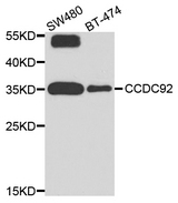CCDC92 Antibody - Western blot analysis of extract of various cells.
