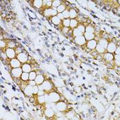 CCDC92 Antibody - Immunohistochemistry of paraffin-embedded Human colon using CCDC92 Polyclonal Antibody at dilution of 1:100 (40x lens).