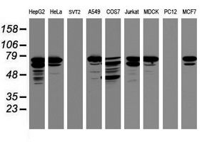 CCDC93 Antibody - Western blot of extracts (35 ug) from 9 different cell lines by using anti-CCDC93 monoclonal antibody (HepG2: human; HeLa: human; SVT2: mouse; A549: human; COS7: monkey; Jurkat: human; MDCK: canine; PC12: rat; MCF7: human).