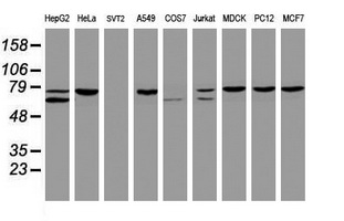 CCDC93 Antibody - Western blot of extracts (35ug) from 9 different cell lines by using anti-CCDC93 monoclonal antibody (HepG2: human; HeLa: human; SVT2: mouse; A549: human; COS7: monkey; Jurkat: human; MDCK: canine; PC12: rat; MCF7: human).