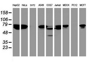 CCDC93 Antibody - Western blot of extracts (35 ug) from 9 different cell lines by using anti-CCDC93 monoclonal antibody (HepG2: human; HeLa: human; SVT2: mouse; A549: human; COS7: monkey; Jurkat: human; MDCK: canine; PC12: rat; MCF7: human).