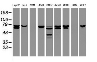 CCDC93 Antibody - Western blot of extracts (35 ug) from 9 different cell lines by using anti-CCDC93 monoclonal antibody (HepG2: human; HeLa: human; SVT2: mouse; A549: human; COS7: monkey; Jurkat: human; MDCK: canine; PC12: rat; MCF7: human).