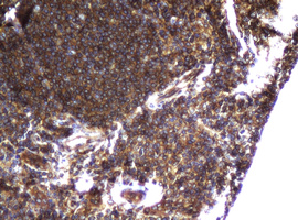 CCDC93 Antibody - IHC of paraffin-embedded Human lymph node tissue using anti-CCDC93 mouse monoclonal antibody.