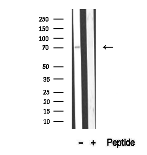 CCDC93 Antibody - Western blot analysis of extracts of Jurkat cells using CCDC93 antibody.