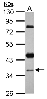 CCDC94 Antibody - Sample (30 ug of whole cell lysate) A: Jurkat 10% SDS PAGE CCDC94 antibody diluted at 1:1000