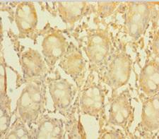 CCDC94 Antibody - Immunohistochemistry of paraffin-embedded human colon tissue using CCDC94 Antibody at dilution of 1:100