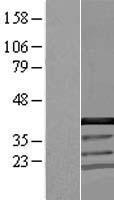 CCDC94 Protein - Western validation with an anti-DDK antibody * L: Control HEK293 lysate R: Over-expression lysate