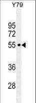CCDC97 Antibody - CCDC97 Antibody western blot of Y79 cell line lysates (35 ug/lane). The CCDC97 antibody detected the CCDC97 protein (arrow).